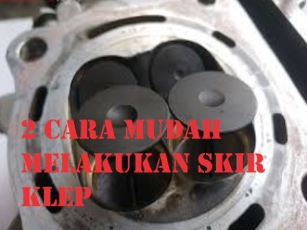 2 Cara Mudah Melakukan Skur Klep