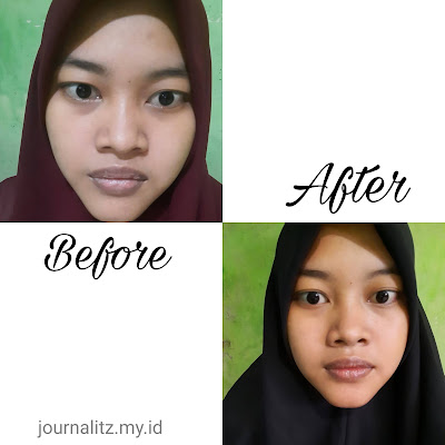 Before After Pemakaian