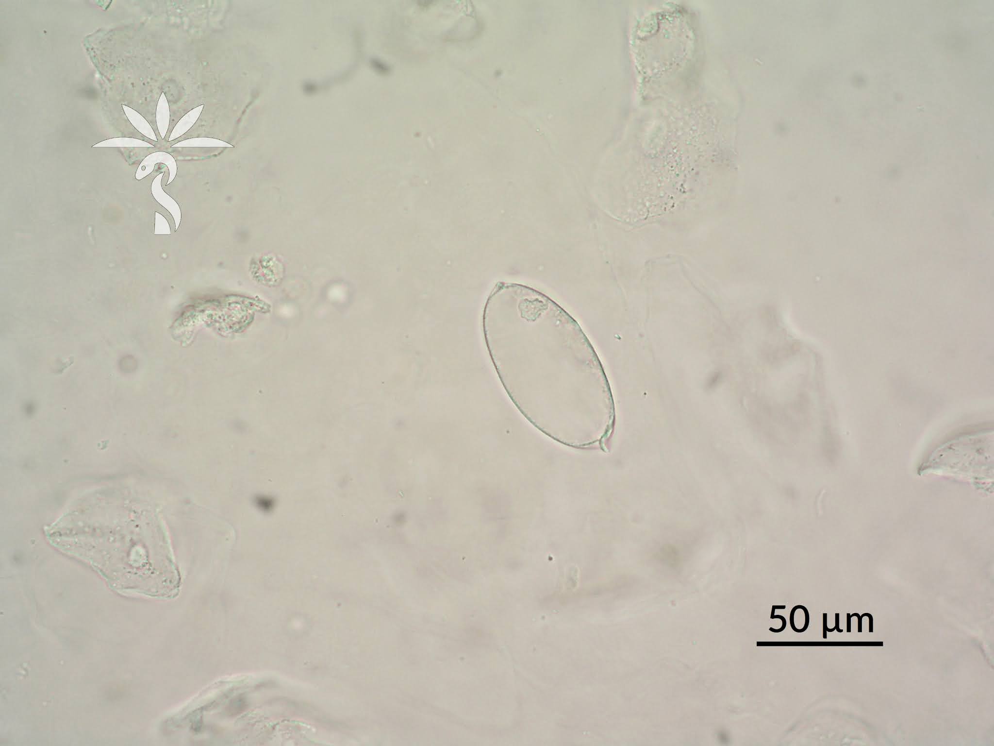 Creepy Dreadful Wonderful Parasites Case of the Week 609