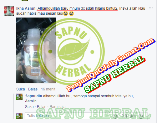 Cara Menyembuhkan Gatal Pada Kulit yang Tidak Kunjung Sembuh Sampai Tuntas Cara Menyembuhkan Gatal Pada Kulit yang Tidak Kunjung Sembuh Sampai Tuntas
