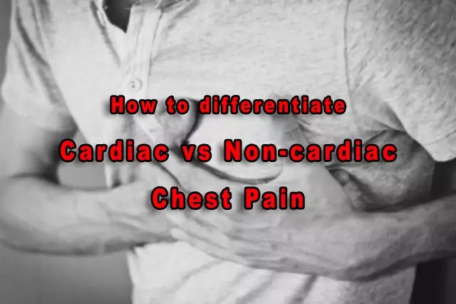 7 differentiating features of cardiac vs noncardiac chest pain