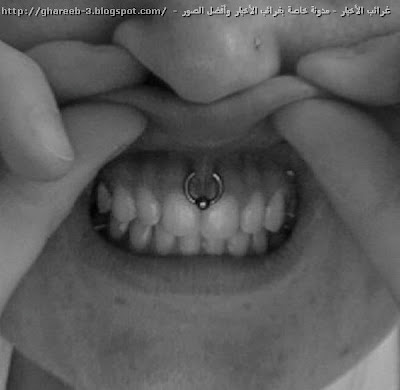 أغرب طرق التجميل