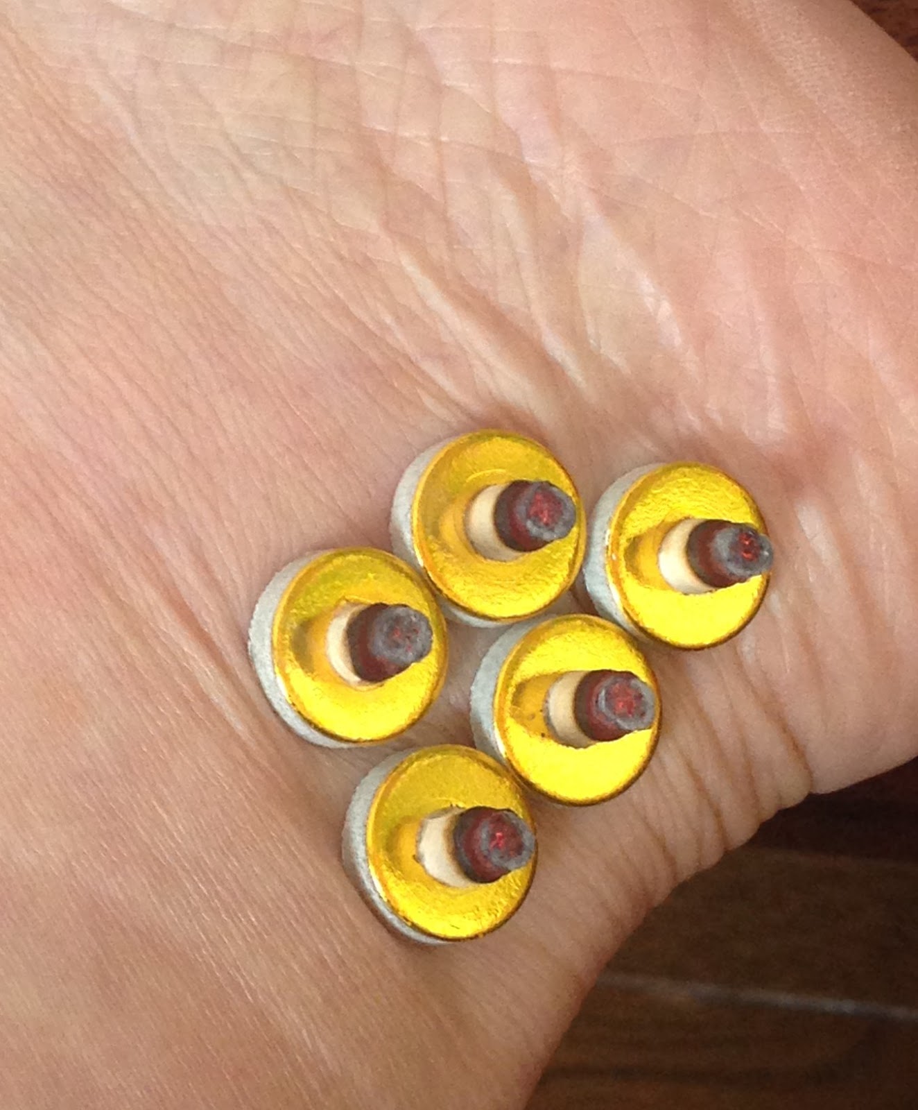 青村ゆかりのブログ アキレス腱周囲炎