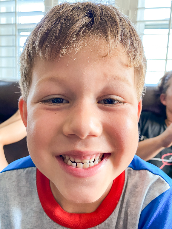 Tales of the Flowers: Ian loses his 3rd tooth - National Tooth Fairy ...