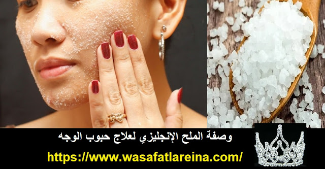 وصفة الملح الإنجليزي لعلاج حبوب الوجه وصفة الملح الإنجليزي لعلاج حبوب الوجه