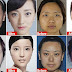 Perché così tanti giovani cinesi cercano la chirurgia plastica