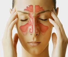 Treatment Of Sinus-साइनस का उपचार Sinus