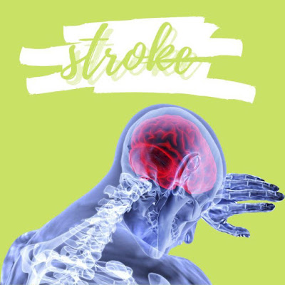 penyebab stroke secara umum