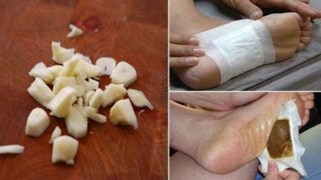 Menguras Racun Dalam Tubuh Hanya Semalam, Seperti Produk Kinok! Anda Bisa Coba Dengan Bahan Alami Ini