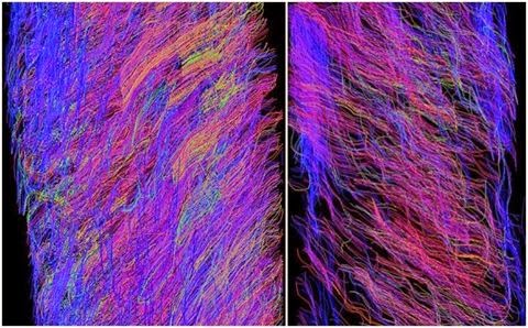 移植技術再突破 人造食道實驗奏功