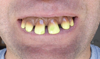 Funny Teeth