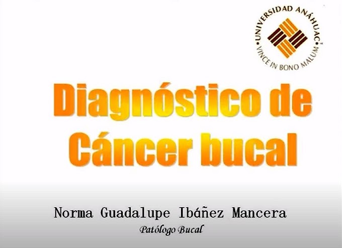 WEBINAR: Diagnóstico de CÁNCER BUCAL - Dra. Norma Guadalupe Ibáñez Mancera