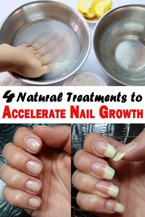 Remedy That Makes Your Nails Grow Faster in Just 8 Days Remedies Well