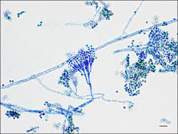 Penicillium sp. Penicillium sp.