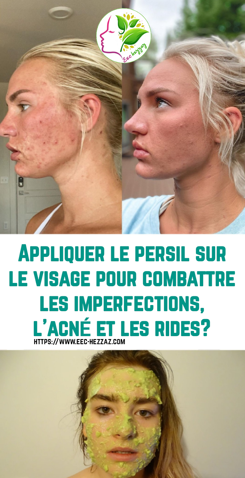 Appliquer le persil sur le visage pour combattre les imperfections, l'acné et les rides?