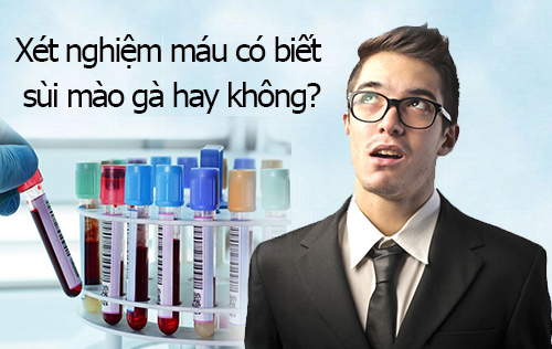 xét nghiệm máu có biết sùi mào gà