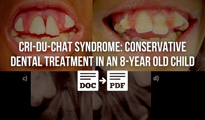 PDF: Cri-du-Chat syndrome: conservative dental treatment in an 8-year old child