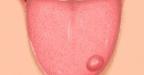 What Your Tongue Is Trying To Tell You About Your Health - healhty and tips