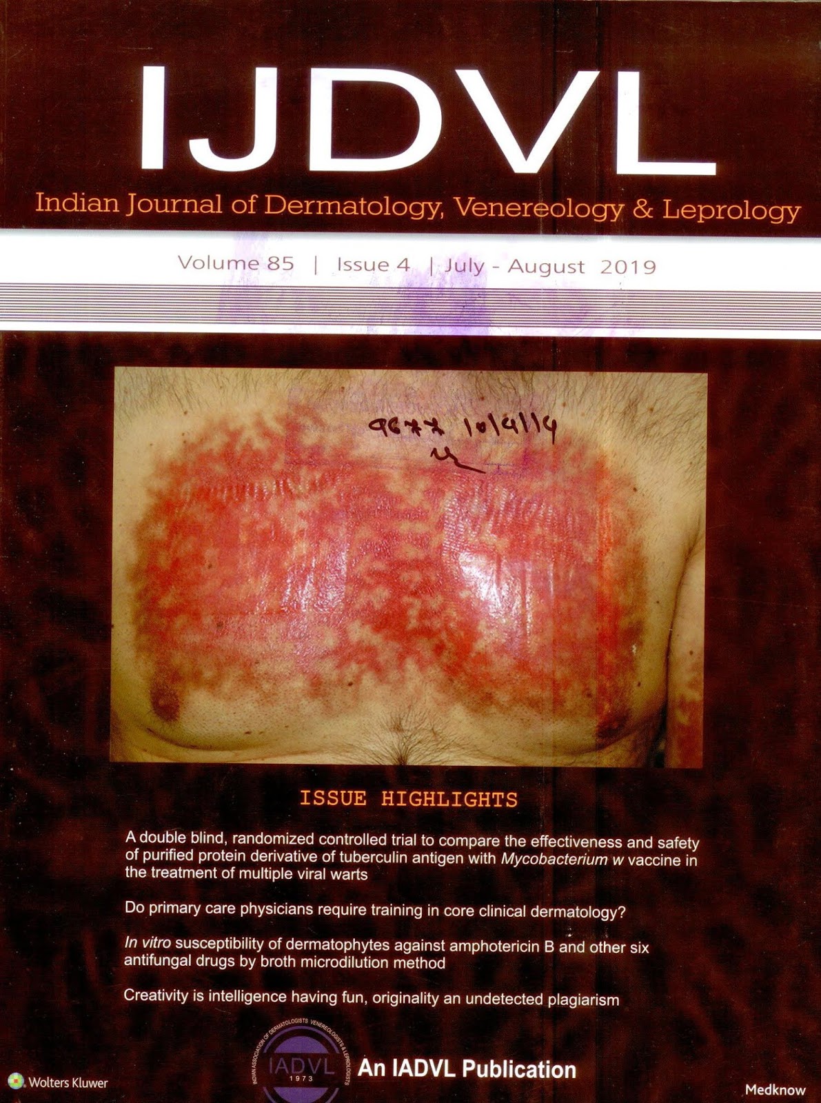 http://www.ijdvl.com/showBackIssue.asp?issn=0378-6323;year=2019;volume=85;issue=4;month=July-August