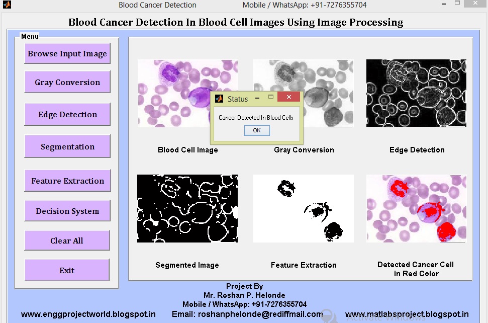 Matlab Code for Blood / Leukemia Cancer Detection Using Image ...