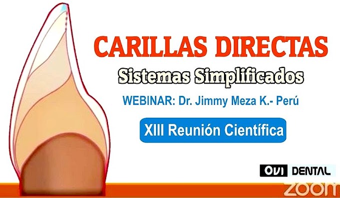 WEBINAR: CARILLAS DENTALES DIRECTAS, Sistemas simplificados - Dr. Jimmy Meza K.