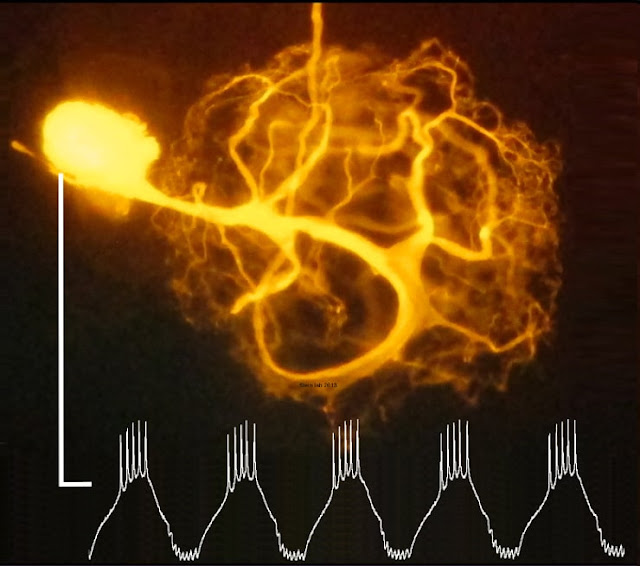 Нейрон с ритмической активностью в кишечном ганглии краба Иона (Cancer borealis). Флуоресцентное окрашивание.
