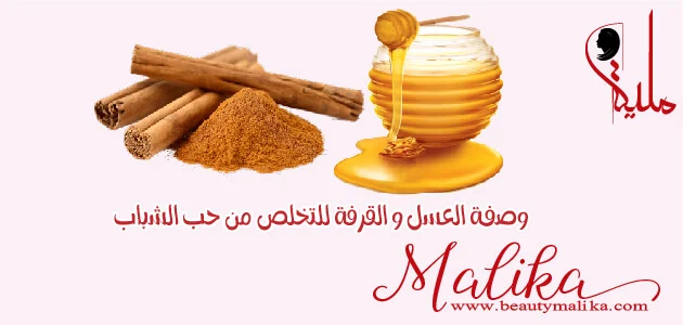 وصفة العسل و القرفة لإزالة حب الشباب وصفة العسل و القرفة للتخلص حب الشباب