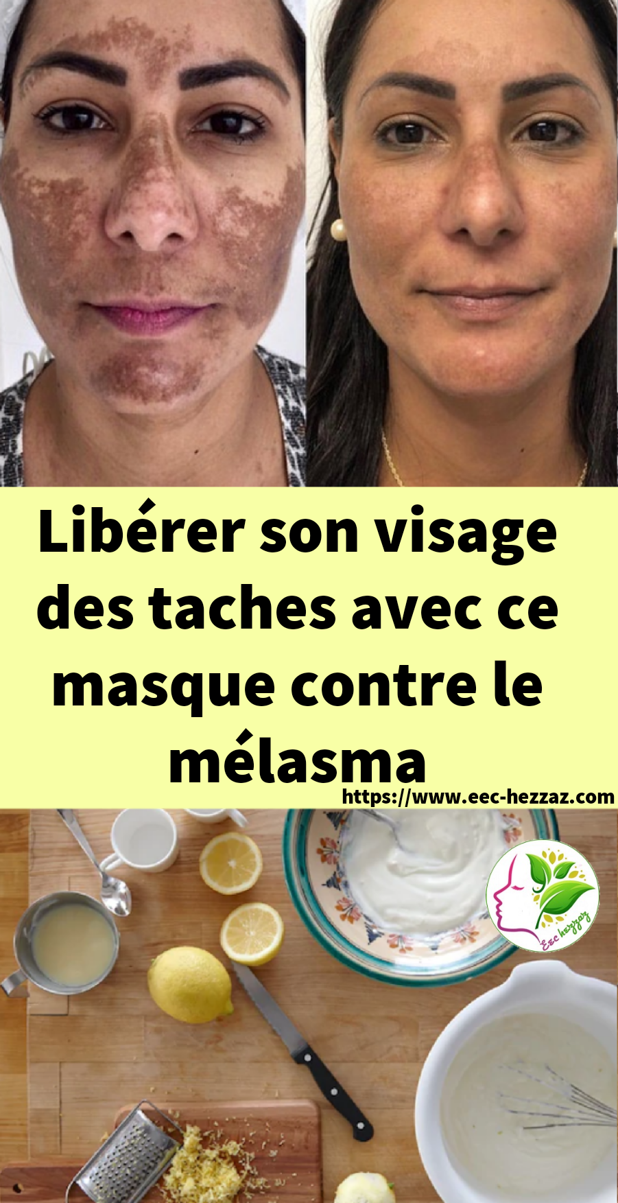 Libérer son visage des taches avec ce masque contre le mélasma