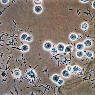 idrarda bakteri