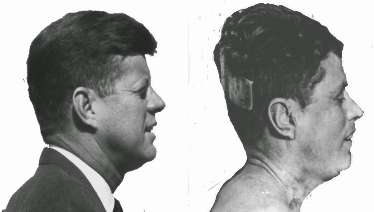 Now here is a comparison image of JFK