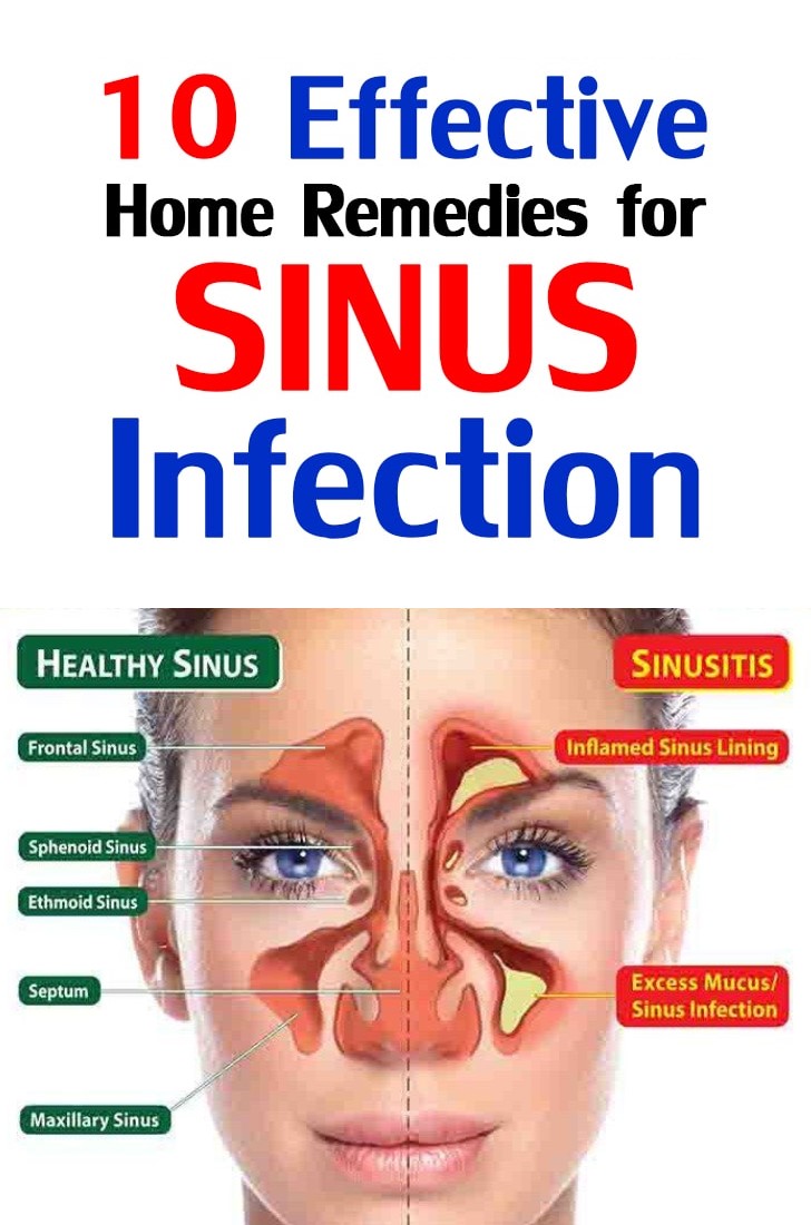 Simple Home Remedies for Sinus Infection - Healthy Lifestyle
