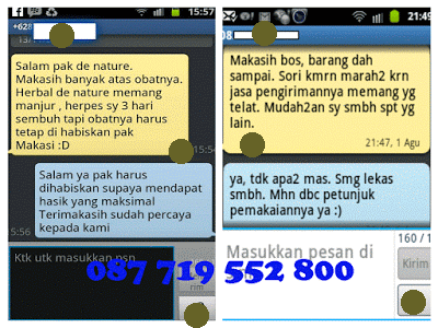 testimoni penyakit herpes testimoni penyakit herpes