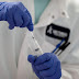 Τσιόδρας:Υπό διερεύνηση   το αν προστατεύει από τον κορωνοϊό το εμβόλιο της φυματίωσης 