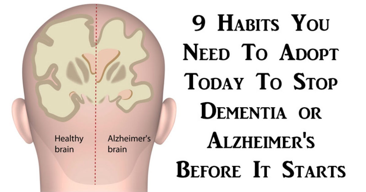 9 Habits To Adopt To Prevent Alzheimer's Disease And Dementia