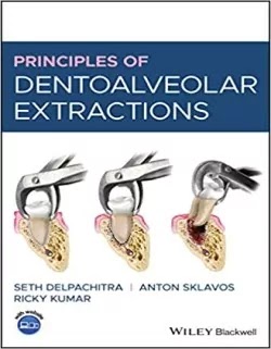 Download Principles of Dentoalveolar Extractions PDF