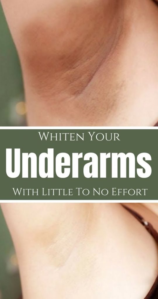 365 AIMS 3 Ways You Can Use Baking Soda To Whiten Your Underarms!