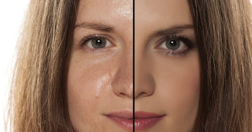 Medical for Us Beauty Corner How To Deal With Oily Face?