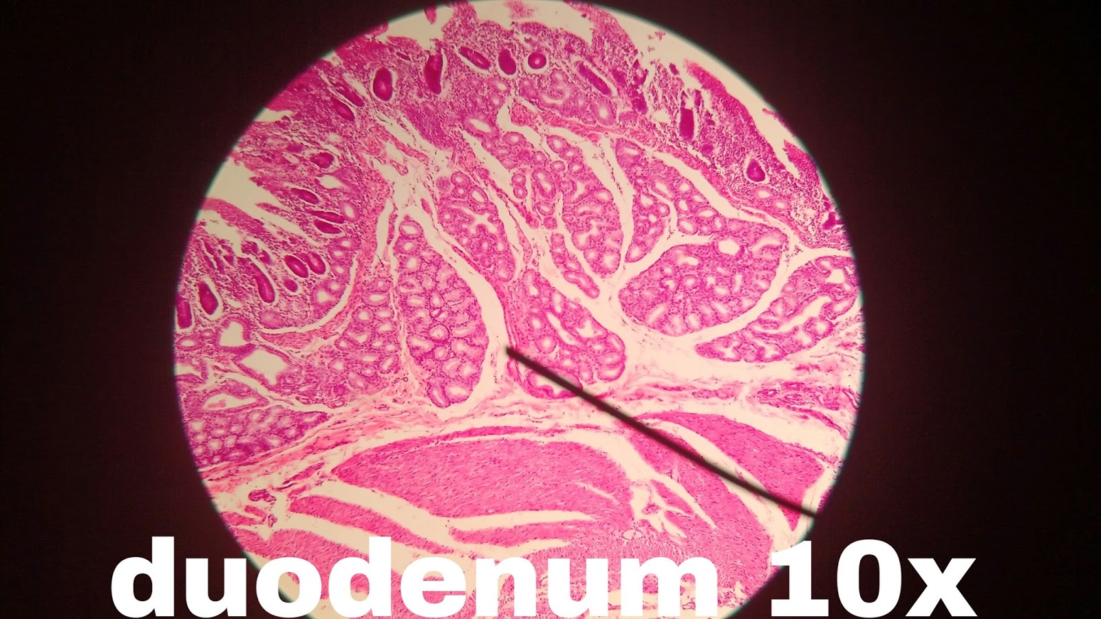 THEONEDESTINY Duodenum Histology