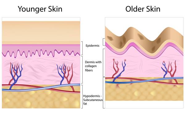 Pengambilan Collagen akan menegangkan kulit? Fakta atau auta