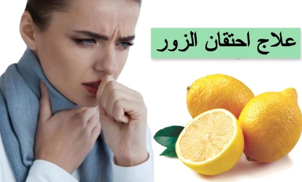 علاج احتقان الزور علاج احتقان الزور