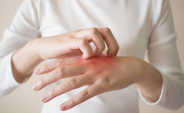Diet for gout patients to control the condition well Diet for gout patients to control the condition well