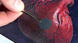 Các nhà nghiên cứu tạo ra miếng dán nano cho tim