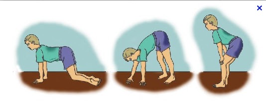 Quike & Vivi's World: Gowers' maneuver Duchenne Muscular Dystrophy