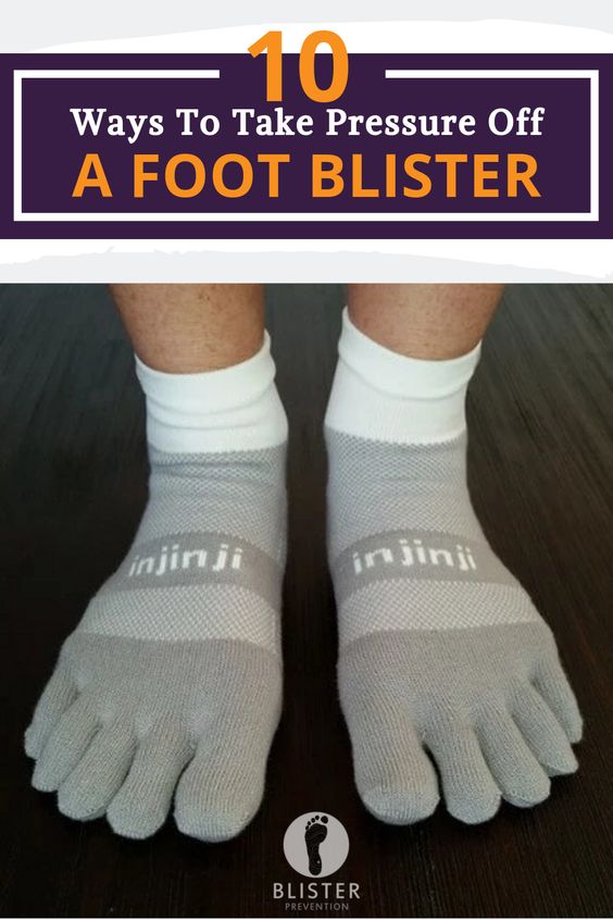 blood control remedies treatment for diabetic foot blisters