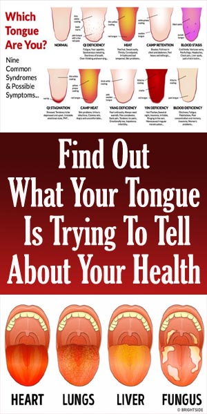 Find Out What Your Tongue Is Trying To Tell About Your Health ...