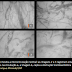 Registrado ao vivo a formação de coágulos em vasos sanguíneos de pacientes com COVID-19