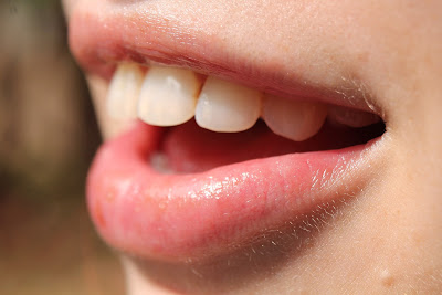 Δόντια: βότανα και φυσικές θεραπείες