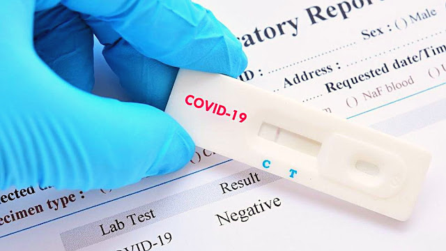 Sağlık Bakanlığı, Valiliklere Covid-19 Test Ücreti Hakkında Yazı Gönderdi
