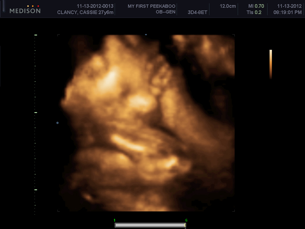 California Clancys 28 weeks! 3D ultrasound!