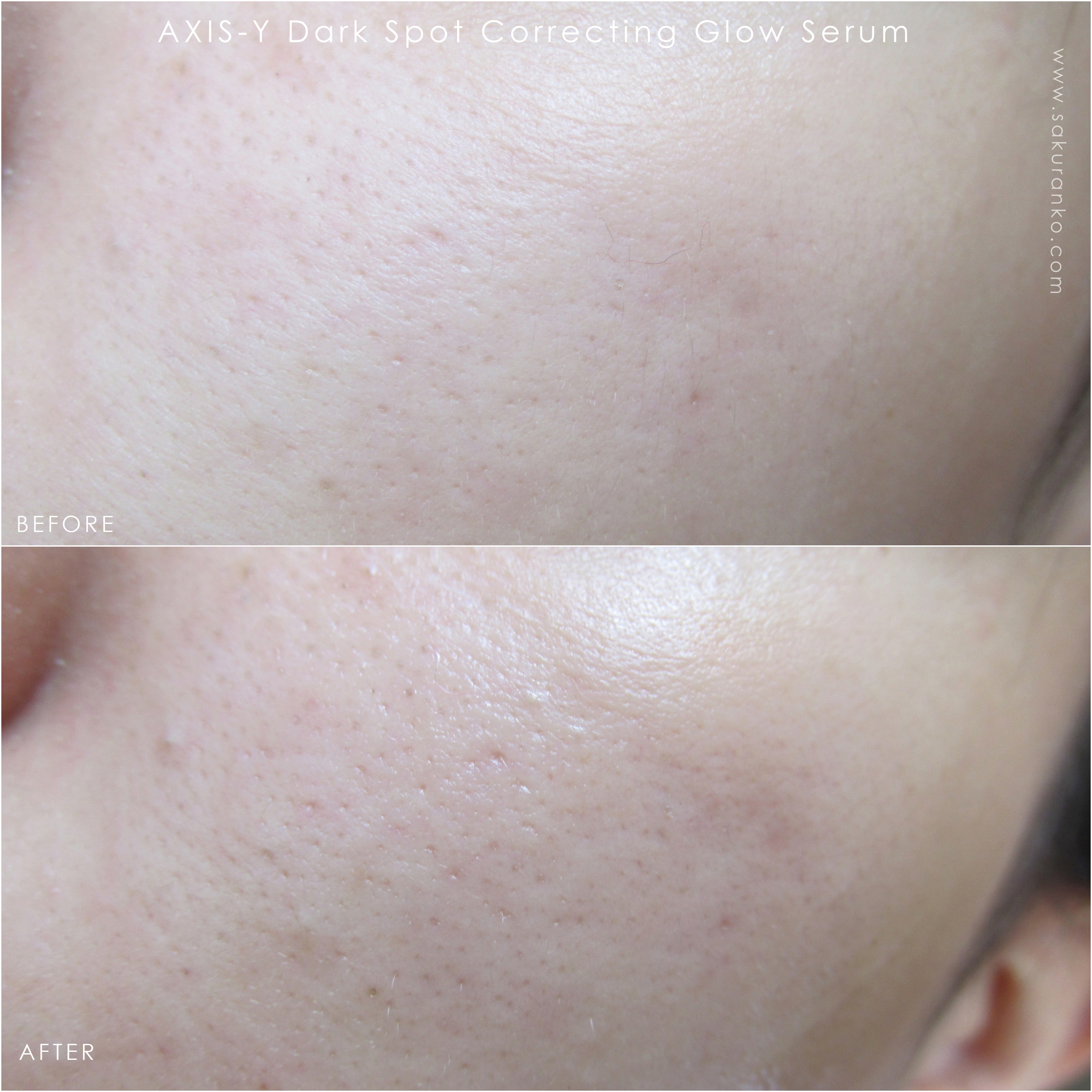 Sakuranko AXISY Dark Spot Correcting Glow Serum Review
